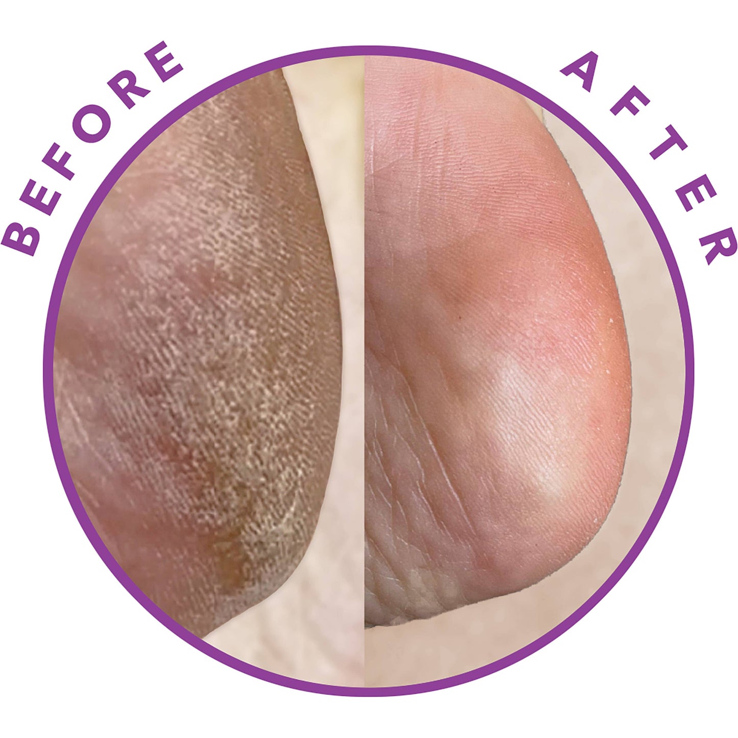 Reboot Exfoliating Foot Peel